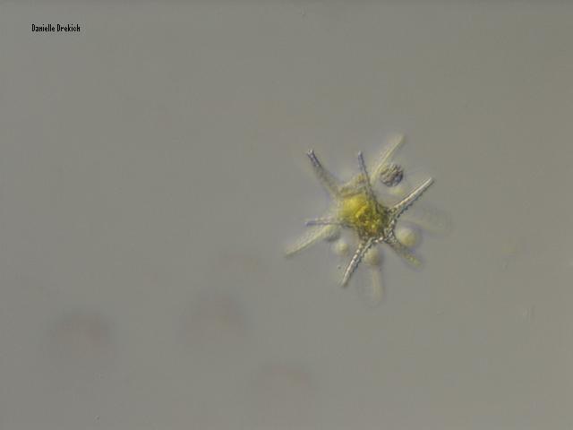 Staruastrum